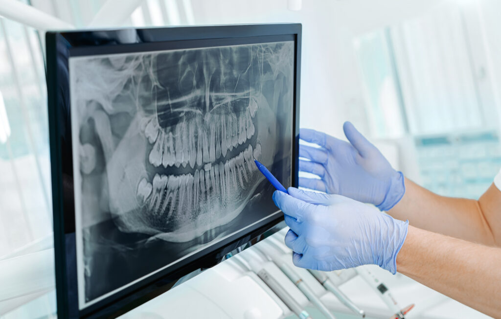 Preventative Dentistry Spokane Valley